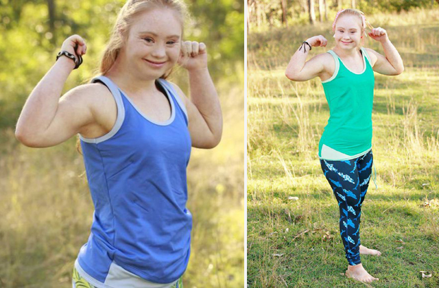Fitneszmárka arca lett a Down-szindrómás tinilány