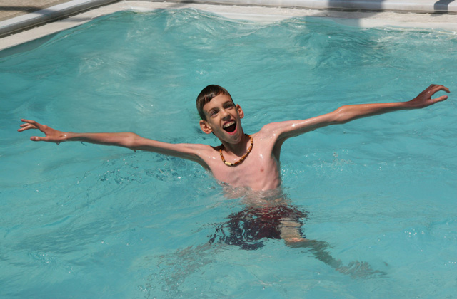 A genetikai rendellenességekkel élők szépségét mutatja meg a fotós - galéria A genetikai rendellenességekkel élők szépségét mutatja meg a fotós - galéria