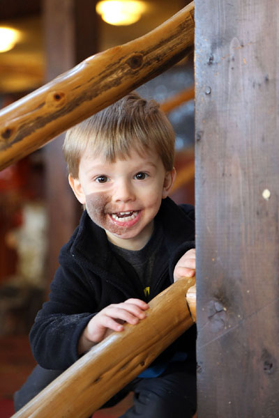A genetikai rendellenességekkel élők szépségét mutatja meg a fotós - galéria