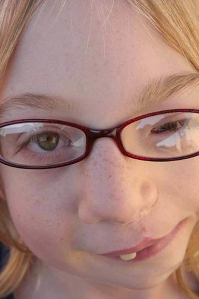 A genetikai rendellenességekkel élők szépségét mutatja meg a fotós - galéria