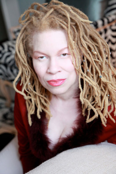 A genetikai rendellenességekkel élők szépségét mutatja meg a fotós - galéria