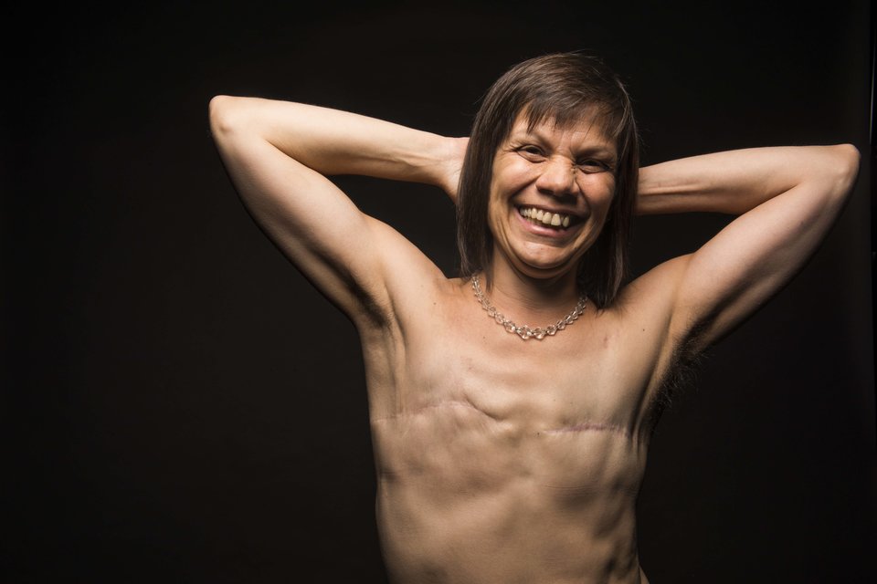 5 nő, aki bátran megmutatja a testén azt, amit mások takargatnának 5 nő, aki bátran megmutatja a testén azt, amit mások takargatnának