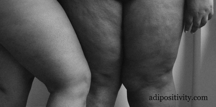 18+: Aktfotókon vállalják testüket a duci modellek