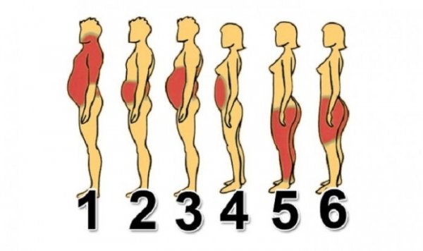 Milyen típusú elhízásból hogyan lehet lefogyni?