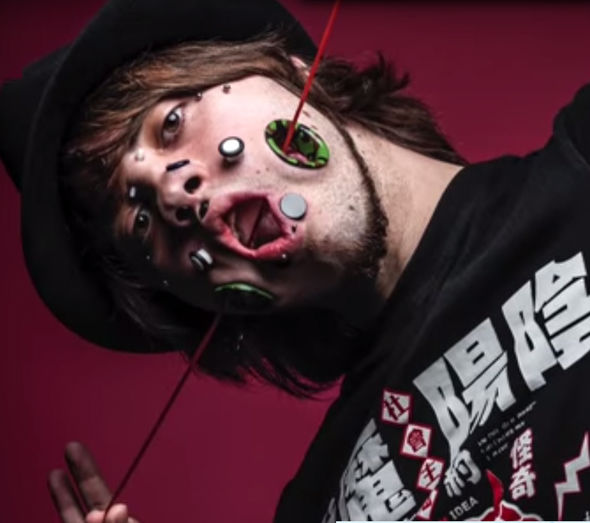 Guinness rekord: ennek a fiúnak van a legtöbb lyuk az arcán