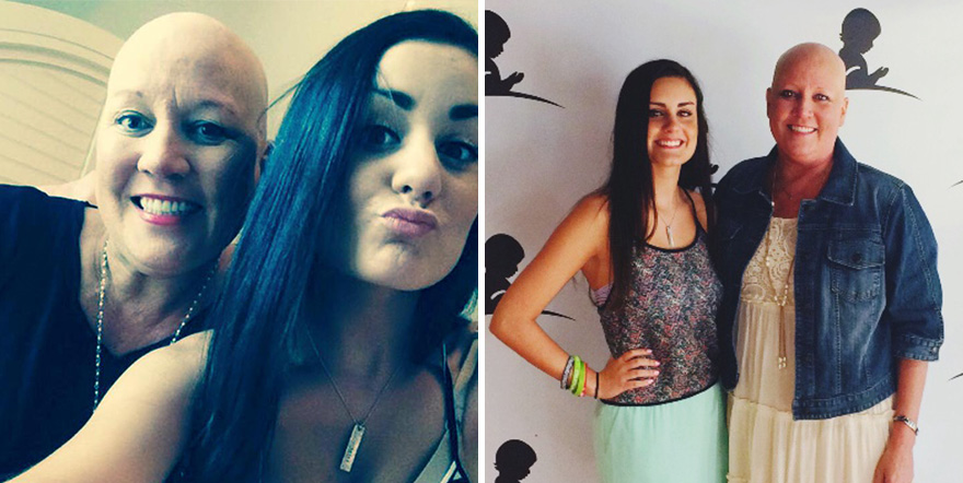 Megható: a báli kísérője is kopaszra borotválta a fejét