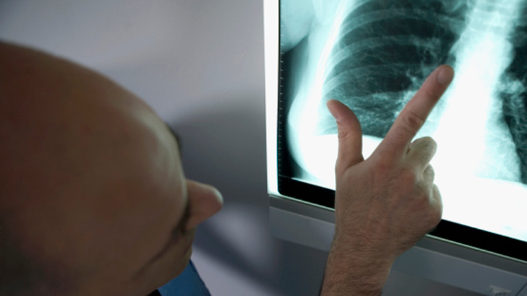 A legközelebb most Bécsben van lehetőség ilyen beavatkozásra