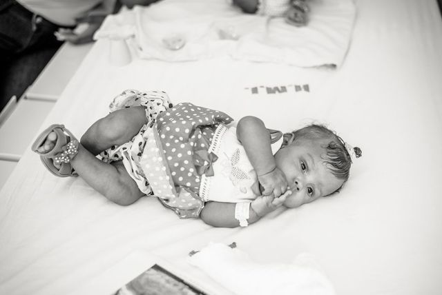 Hatórás műtéttel választották szét a sziámi iker babákat - megható képek