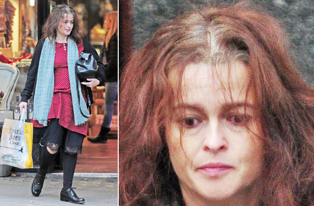 Kopaszodik a világhírű színésznő és bátran mutogatja is - fotók