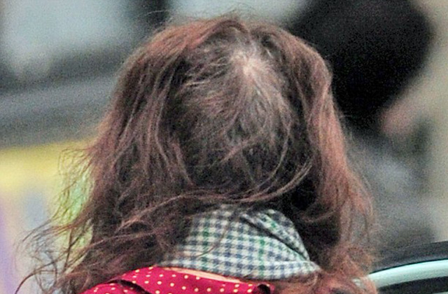 Kopaszodik a világhírű színésznő és bátran mutogatja is - fotók