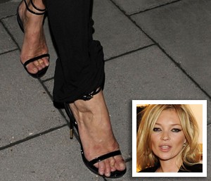 10 celeb, akikről nem is gondolnád, hogy ennyire ronda lábfejük van