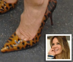 10 celeb, akikről nem is gondolnád, hogy ennyire ronda lábfejük van