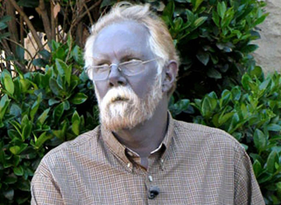 Képeken a világ 10 legdurvább betegsége Képeken a világ 10 legdurvább betegsége