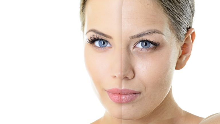 Hogyan vegyük fel a küzdelmet a szarkalábak ellen? (x) Hogyan vegyük fel a küzdelmet a szarkalábak ellen? (x)