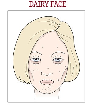 Milyen az arcod? Megmondjuk, mit eszel!