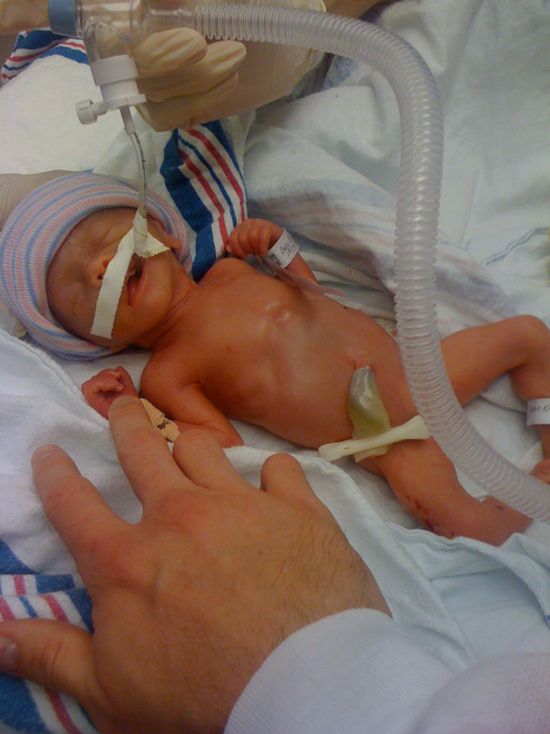 “A kisfiam a 26. héten született