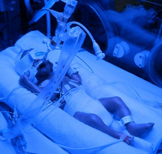 “A kisfiam a 26. héten született