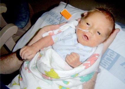 Nézz cuki korababákat a koraszülött világnapon!