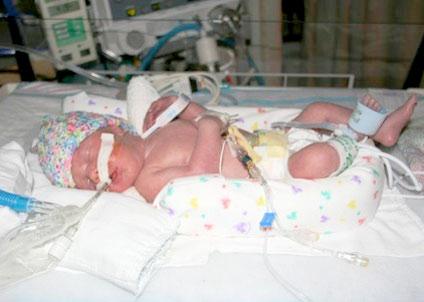 Nézz cuki korababákat a koraszülött világnapon!