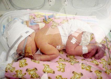 Nézz cuki korababákat a koraszülött világnapon!