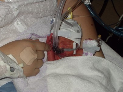 Nézz cuki korababákat a koraszülött világnapon!