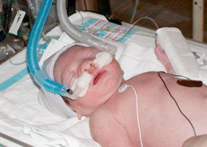 Nézz cuki korababákat a koraszülött világnapon!