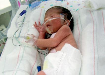 Nézz cuki korababákat a koraszülött világnapon!