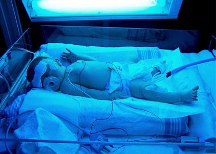 Nézz cuki korababákat a koraszülött világnapon!