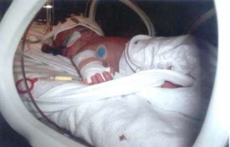 Nézz cuki korababákat a koraszülött világnapon!