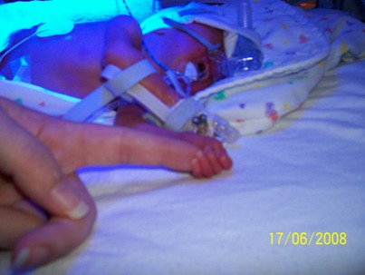 Nézz cuki korababákat a koraszülött világnapon!