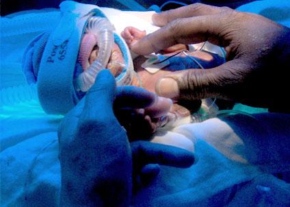 Nézz cuki korababákat a koraszülött világnapon!