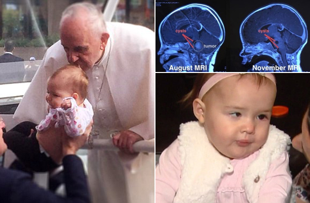 Ferenc pápa megpuszilta, eltűnt az agydaganata a kislánynak