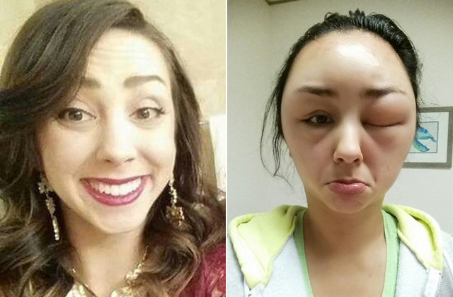 Teljesen eltorzult egy nő arca a hajfestéktől - fotók