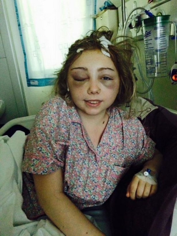 Tudtán kívül, évekig élt agytumorral a tinédzser lány – megrázó történet Tudtán kívül, évekig élt agytumorral a tinédzser lány – megrázó történet