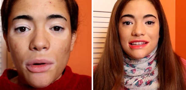 A vitiligo arcai: hihetetlen átváltozás némi smink segítségével