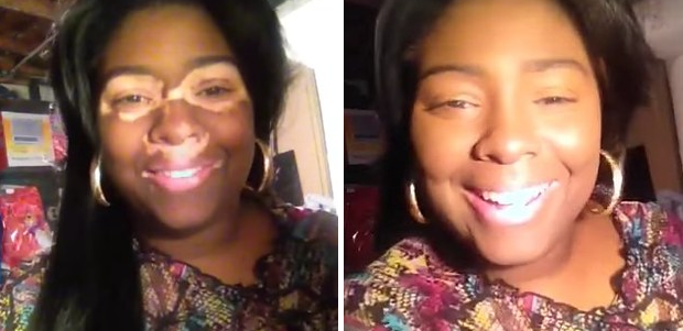 A vitiligo arcai: hihetetlen átváltozás némi smink segítségével