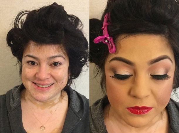 A vitiligo arcai: hihetetlen átváltozás némi smink segítségével