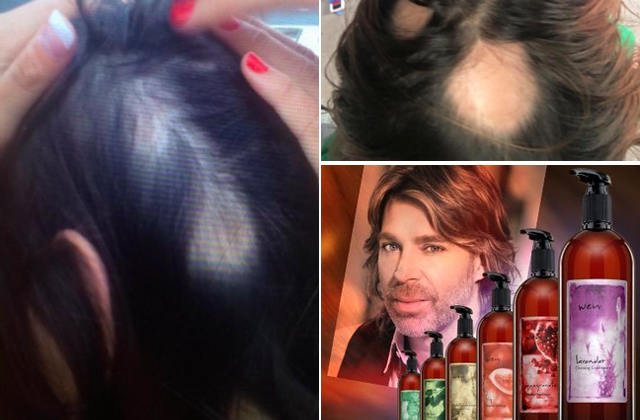 Megkopaszodtak a nők a sztárfodrász hajápolóitól - fotók