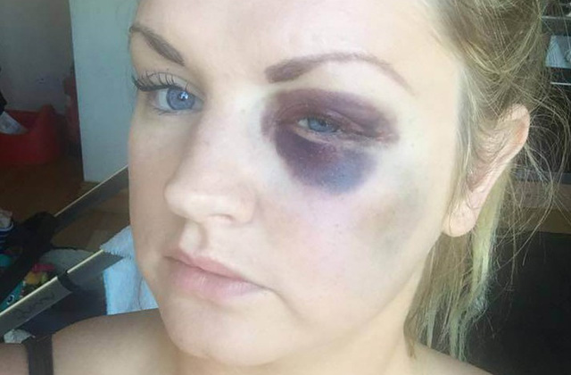 Összeverte a koszorúslányokat a vőlegény Összeverte a koszorúslányokat a vőlegény