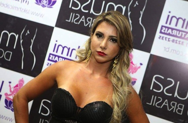 Belehalt a plasztikai műtétbe a modell Belehalt a plasztikai műtétbe a modell