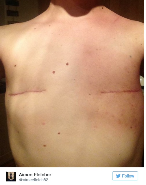 Mell alá csúsztatott tollal bizonyítják nőiességüket a kínai lányok