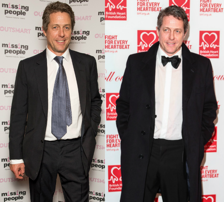 Ilyen lett Hugh Grant arca három hónap alatt Ilyen lett Hugh Grant arca három hónap alatt