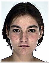 Gyógyszeres kezelés alatt álló fiatal nő tűnt el