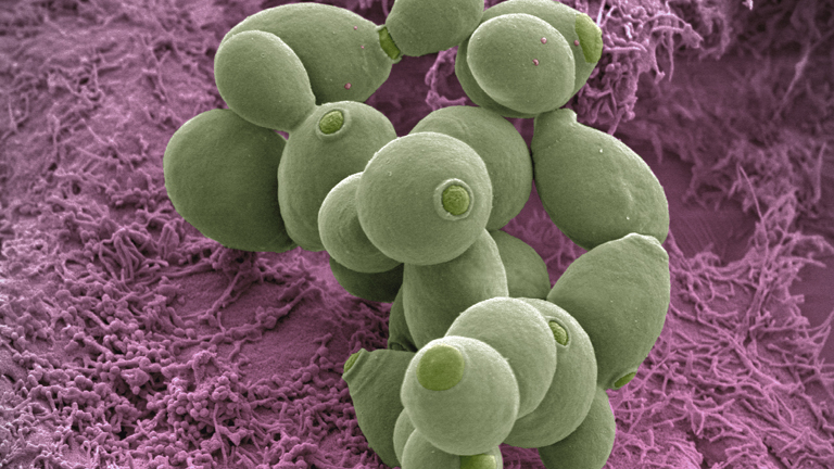 Mit érdemes tudni a Saccharomyces boulardii nevű élesztőgombáról?