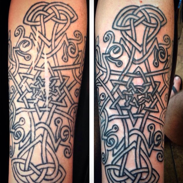 Tetoválásokkal fedi el az erőszak nyomait a művész