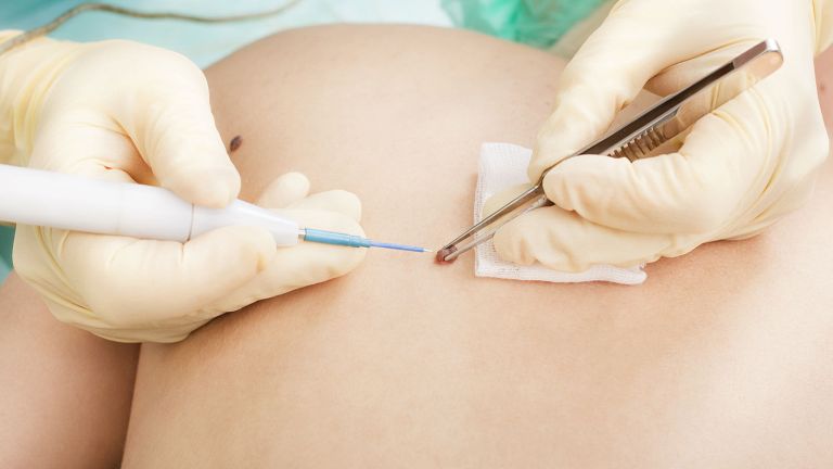 Most érdemes túlesni a bőrgyógyászati beavatkozásokon