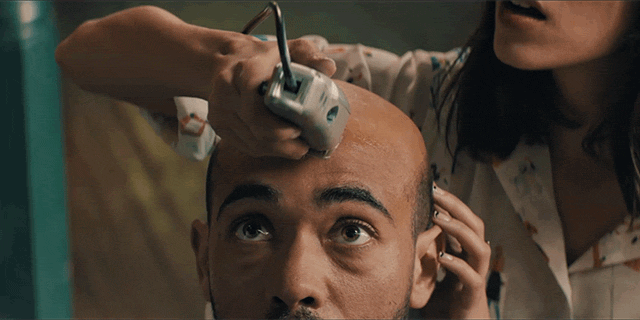 Már embereken tesztelik a kopaszság ellenszerét