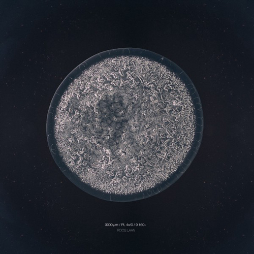 Ilyen szépek közelről a könnyek - képek