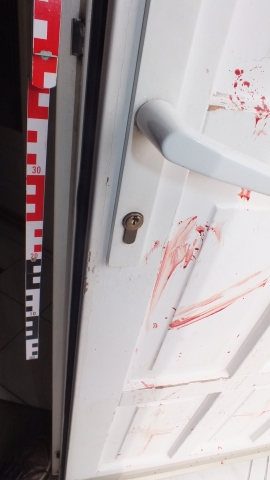 Ököllel verte véresre a bejárati ajtót Ököllel verte véresre a bejárati ajtót