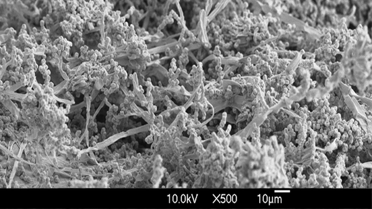 Ochratoxin A elektronmikroszkóp alatt